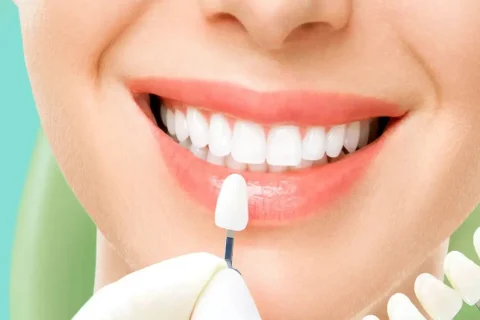 Zirkonyum Diş Kaplama 8 Zirkonyum Diş Kaplama